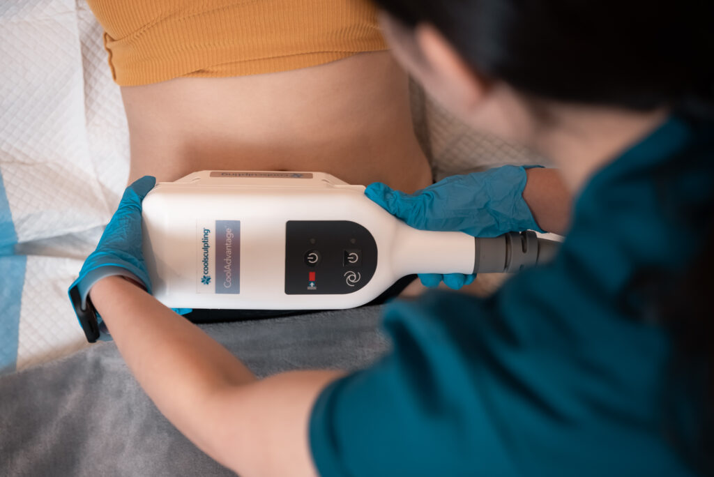 Bodysculpting treatments to remove stubborn fats and belly fats, using Veritas Medical Aesthetic's Coolsculpting treatment